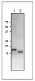 Anti-Ferredoxin 3 antibody used in Western Blot (WB). GTX00918