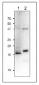 Anti-Ferredoxin C1 antibody used in Western Blot (WB). GTX00919