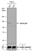 Anti-MVP/LRP antibody [C2C3], C-term used in Western Blot (WB). GTX100536