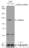 Anti-p130Cas antibody [N2C2], Internal used in Western Blot (WB). GTX100605