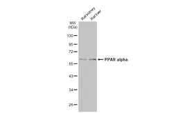Anti-PPAR alpha antibody used in Western Blot (WB). GTX101098