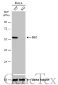Anti-DLD antibody [N1N3] used in Western Blot (WB). GTX101232