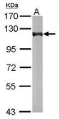 Anti-OGDH antibody [C2C3], C-term used in Western Blot (WB). GTX105124