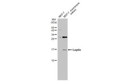 Anti-Leptin antibody used in Western Blot (WB). GTX109204