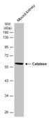 Anti-Catalase antibody used in Western Blot (WB). GTX110704