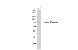 Anti-alpha 1 Catenin antibody [N3C2], Internal used in Western Blot (WB). GTX111095