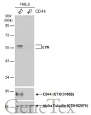 Anti-LYN antibody used in Western Blot (WB). GTX111584