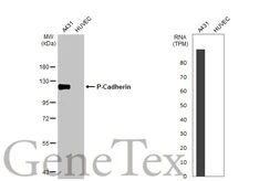 Anti-P-Cadherin antibody used in Western Blot (WB). GTX113648