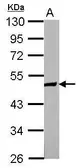 Anti-ZNF322A antibody used in Western Blot (WB). GTX121644