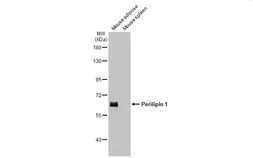 Anti-Perilipin 1 antibody used in Western Blot (WB). GTX130139