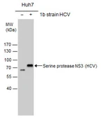 Anti-Hepatitis C virus NS3 protein antibody used in Western Blot (WB). GTX131269