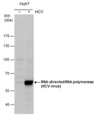 Anti-Hepatitis C virus NS5B protein antibody used in Western Blot (WB). GTX131273