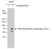 Anti-Hepatitis C virus NS5B protein antibody used in Western Blot (WB). GTX131274