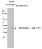 Anti-Hepatitis C virus NS3 protein antibody used in Western Blot (WB). GTX131276
