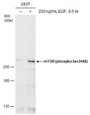 Anti-mTOR (phospho Ser2448) antibody used in Western Blot (WB). GTX132803