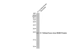 Anti-Yellow Fever virus NS4B Protein antibody used in Western Blot (WB). GTX134030