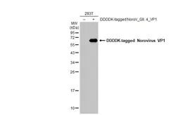 Anti-Norovirus VP1 antibody used in Western Blot (WB). GTX134380