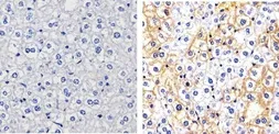 Anti-c-Met (phospho Tyr1003) antibody used in IHC (Paraffin sections) (IHC-P). GTX25656