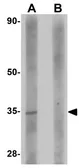 Anti-SDHAF2 antibody used in Western Blot (WB). GTX32033