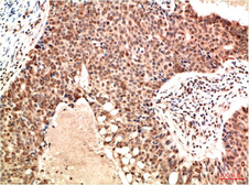 Anti-ATM antibody [4G9] used in IHC (Paraffin sections) (IHC-P). GTX34047