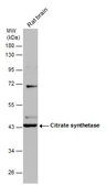 Anti-Citrate synthase antibody [GT2061] used in Western Blot (WB). GTX628144