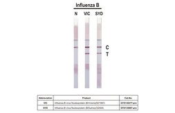 Anti-Influenza B virus Nucleoprotein antibody [HL1069] used in Lateral Flow (Lateral Flow). GTX636100