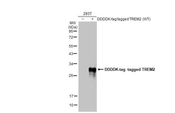 Anti-TREM2 antibody [HL1738] used in Western Blot (WB). GTX637386
