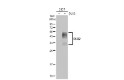 Anti-DLX2 antibody [HL1942] used in Western Blot (WB). GTX637779