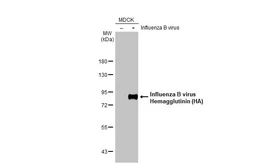 Anti-Influenza B virus Hemagglutinin (HA) antibody [HL2208] used in Western Blot (WB). GTX638212
