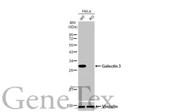 Anti-Galectin 3 antibody [HL2397] used in Western Blot (WB). GTX638614