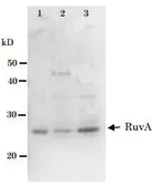 Anti-RuvA antibody used in Western Blot (WB). GTX64162