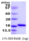 Human Iba1 protein, His tag. GTX67205-pro