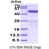 Human ADRM1 protein, His tag. GTX68220-pro