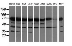 Anti-PUS7 antibody [4C6] used in Western Blot (WB). GTX83757
