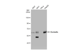 Anti-Occludin antibody used in Western Blot (WB). GTX85016